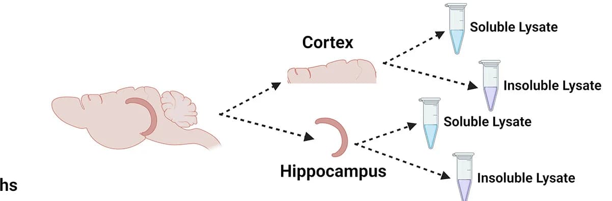 Open access visualization of Workflow, Illustration, Cortical Tissue, Hippocampal Tissue, Microdissection
