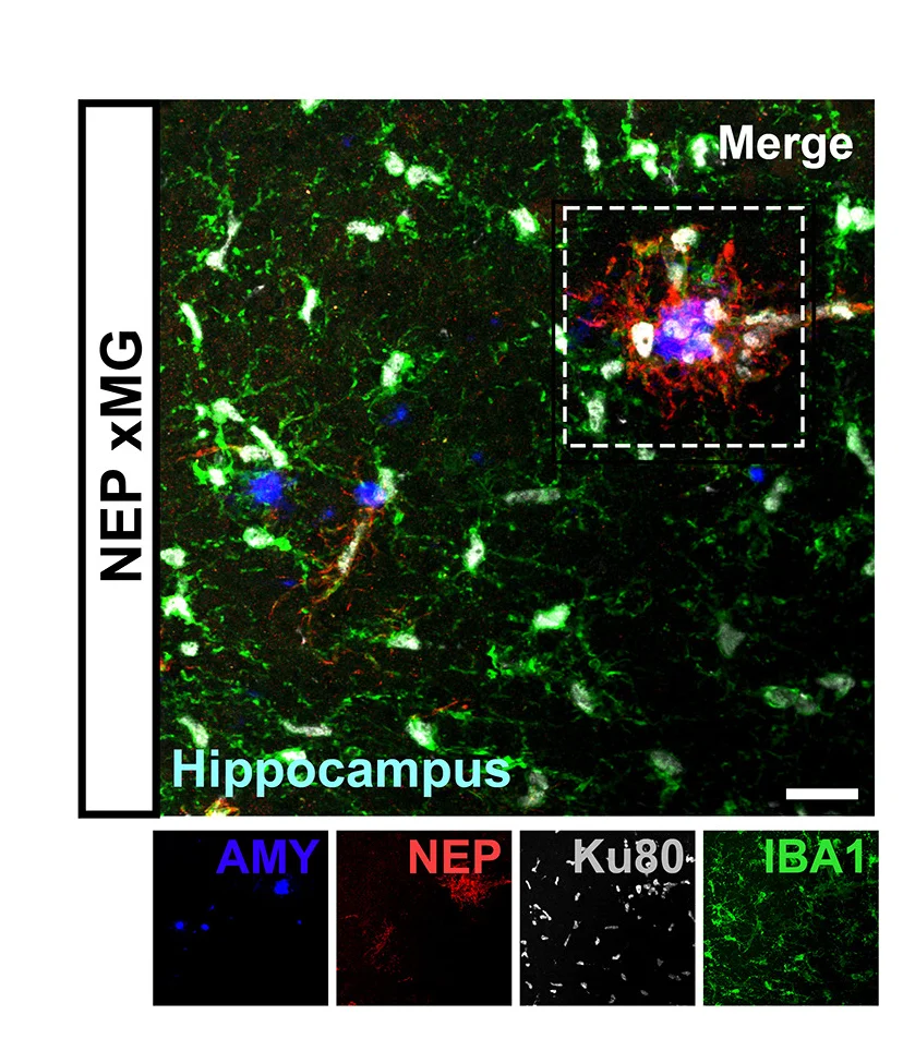 Open access visualization of Microscopy, Confocal Microscopy, Human xMG, Ku80, Nuclear Marker