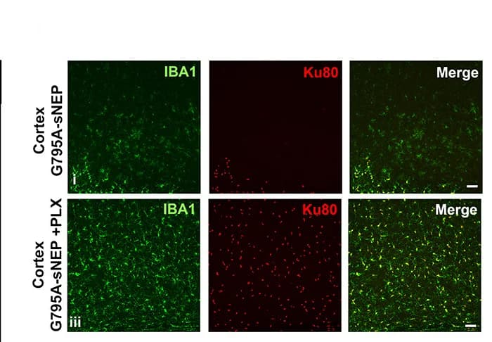 Open access visualization of Microscopy, Microglia, IBA-1, Ku80, Cortex