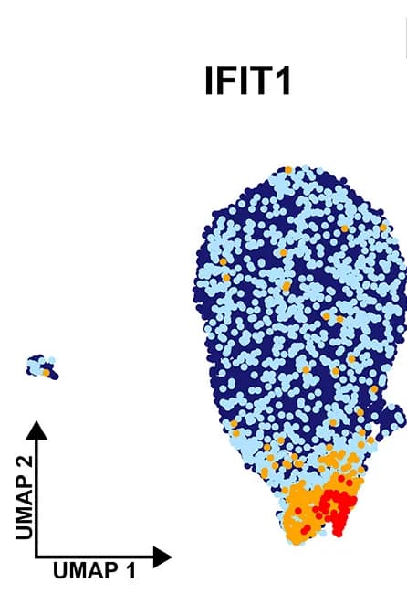 Open access visualization of UMAP, Scatter Plot, IFIT1 Expression, Cell Clusters