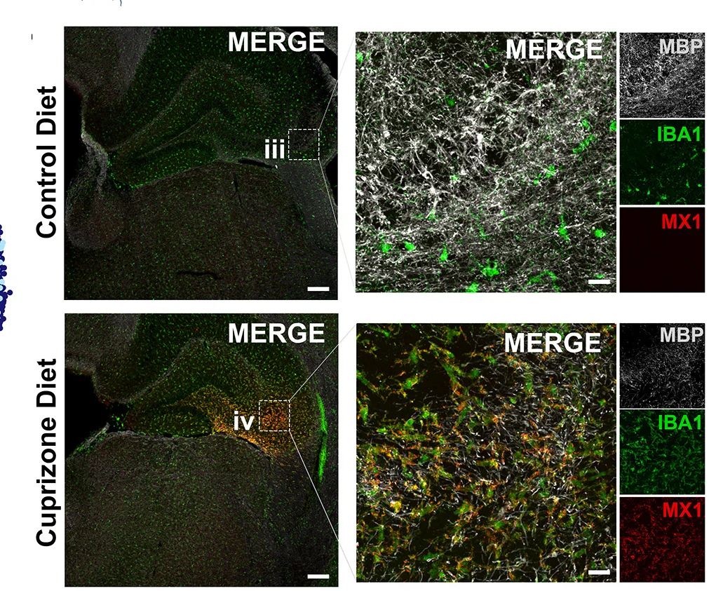 Open access visualization of Microscopy, Confocal Microscopy, Human xMG, IBA1, Control Diet Mice