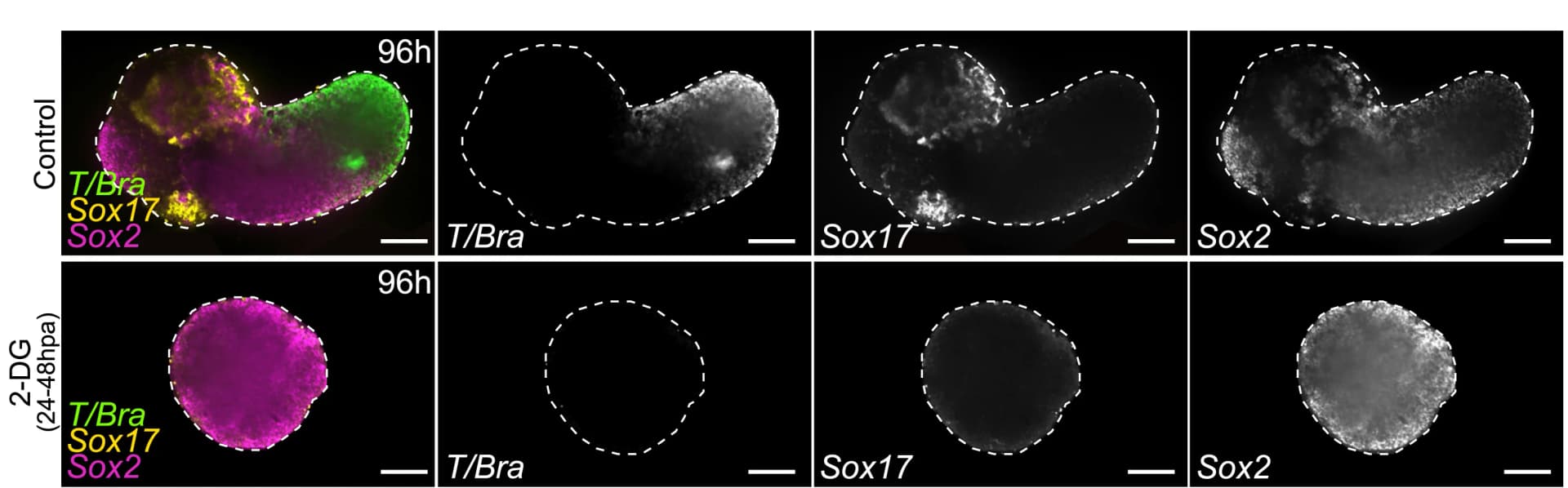 Open access visualization of Microscopy, HCR Stainings, Control Gastruloids, 2-DG-treated Gastruloids, Confocal