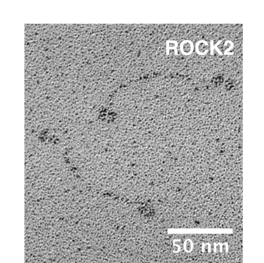 Open access visualization of Microscopy, Electron Microscopy, Rotary Shadowing, Homo Sapiens, ROCK2