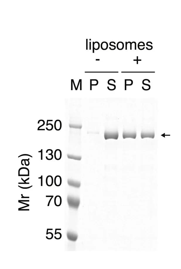 Open access visualization of Gel, MRCK1, Liposomes, Pelleting assay