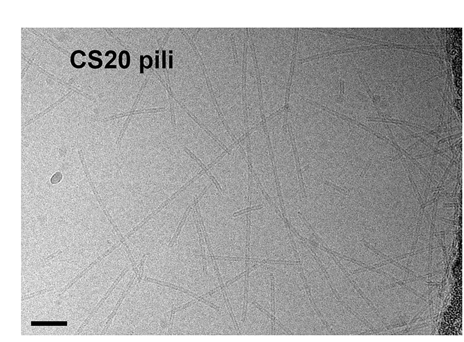 Open access visualization of Microscopy, ETEC Adhesion Pili, Helical Filaments, Cryo-EM Images, CFA/I Pili