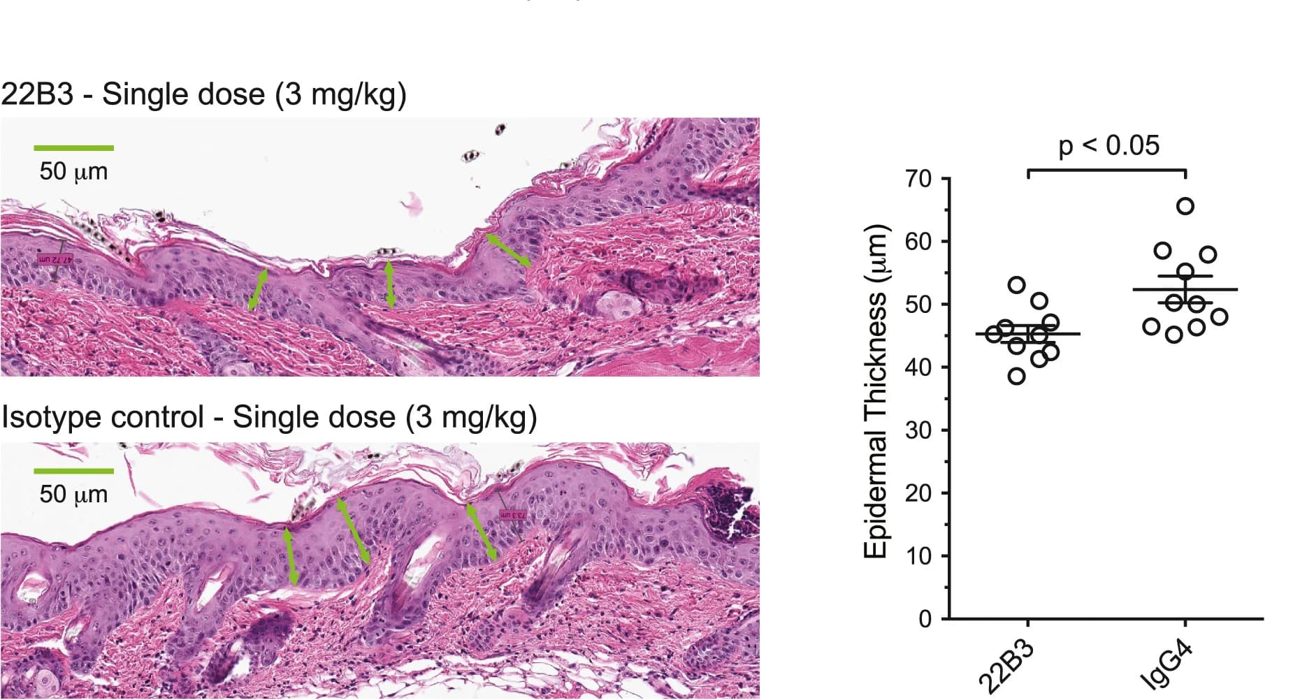 Open access visualization of Scatter Plot, Skin Inflammation, Mouse Model, Psoriasis, Histology