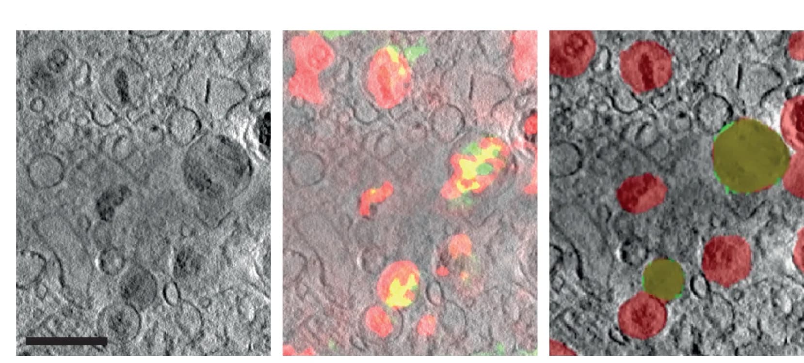 Open access visualization of Microscopy, Tomogram Slice, Neurons, LysoTracker, A42-Alexa Fluor 488