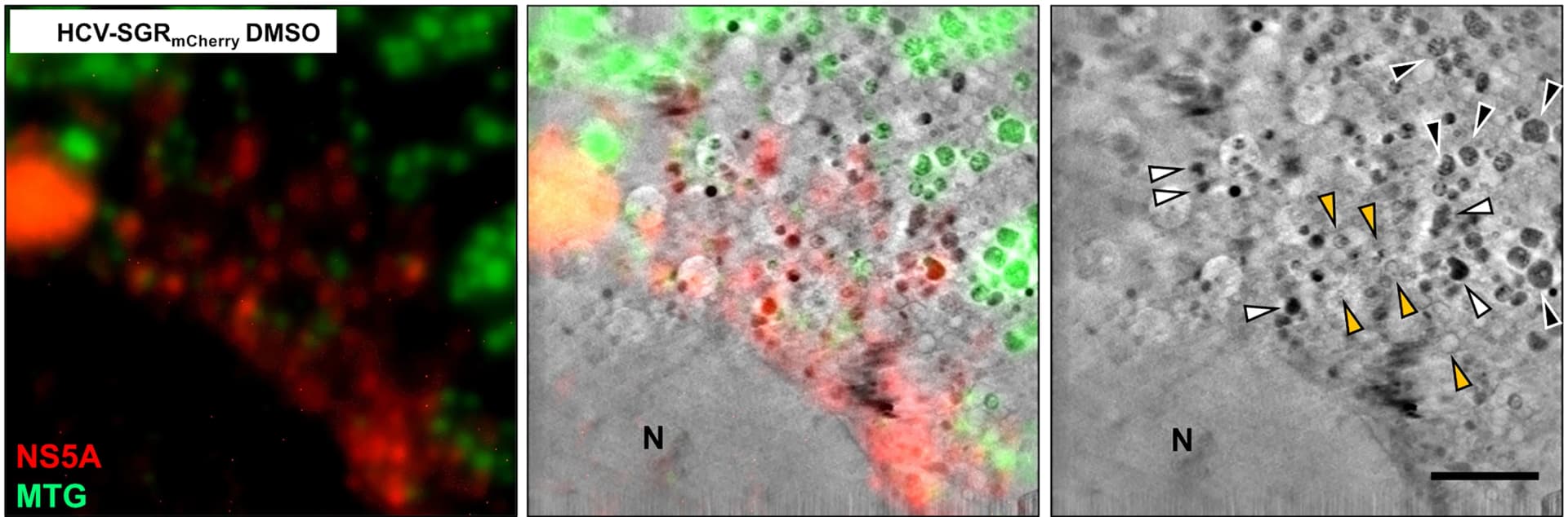 Open access visualization of Microscopy, HCV-SGR Cells, HCV-SGRmCherryreplicon, Cryo-epifluorescence Microscopy, Cryo-SXT