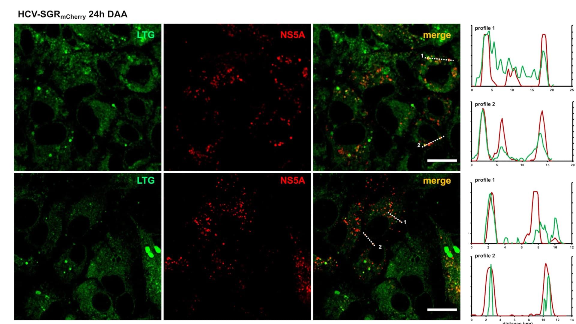 Open access visualization of Microscopy, Line Plot, HCV-SGRmCherry Cells, DAA, Treated