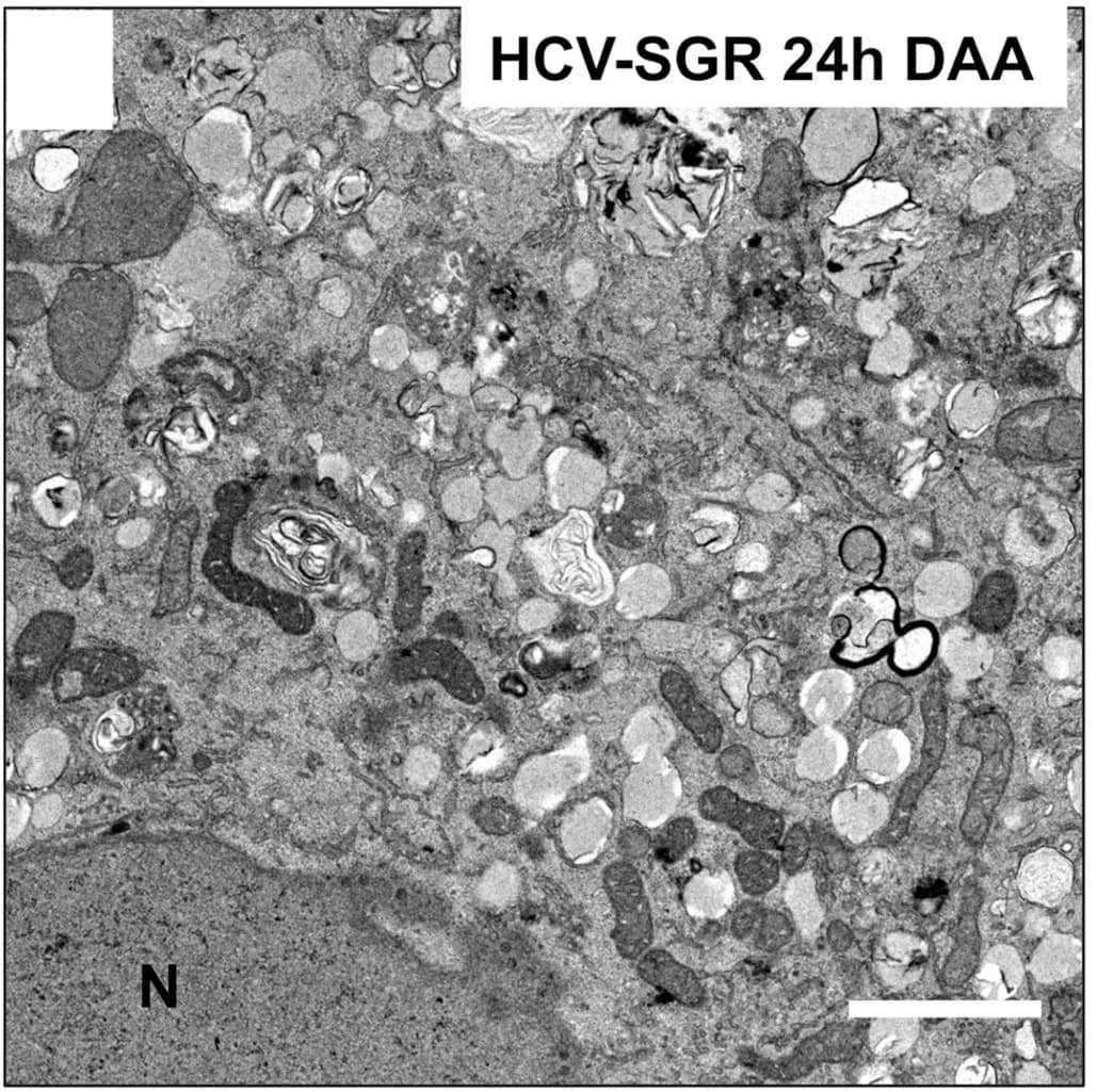 Open access visualization of Microscopy, DAA, Ultrastructural Alterations, HCV, Nucleus