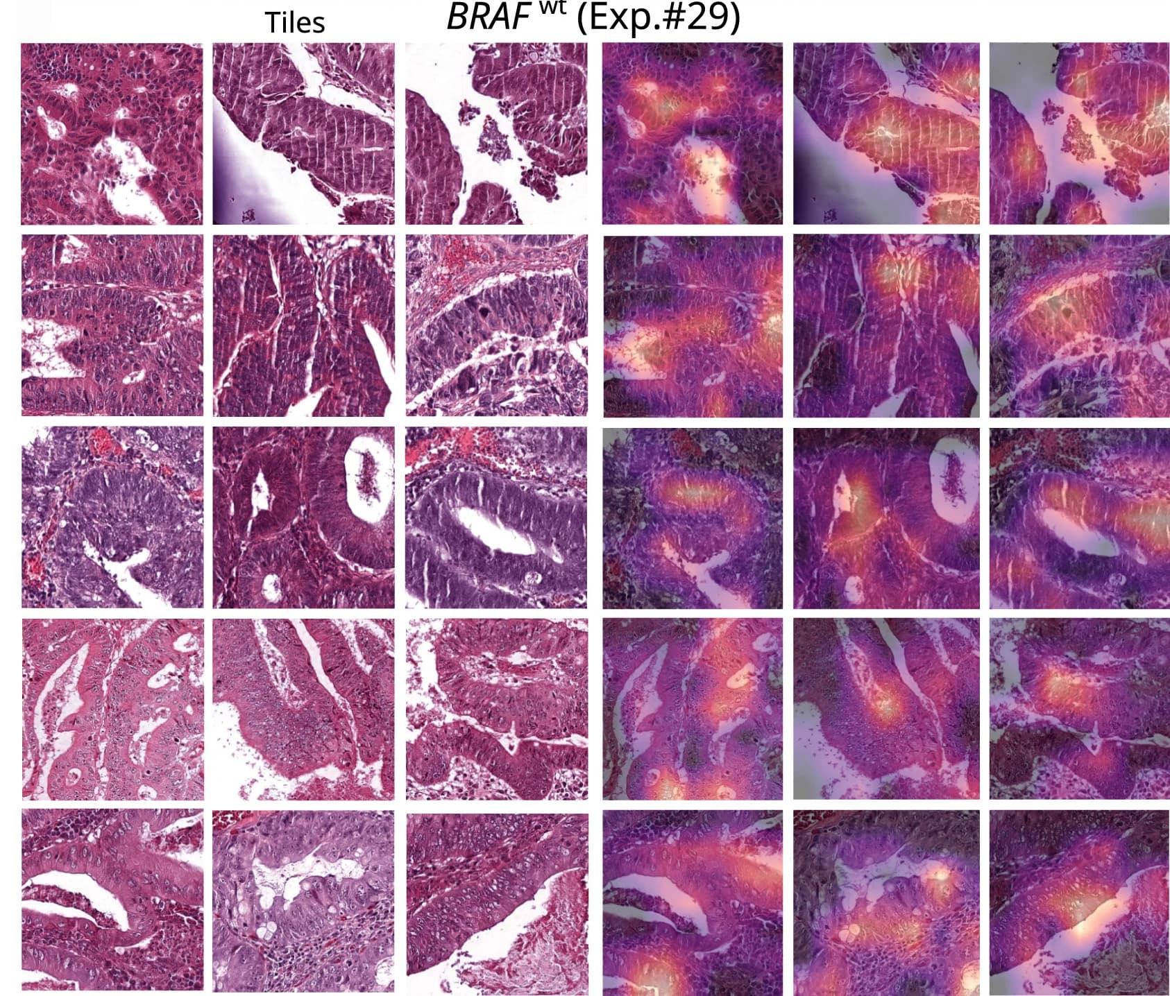Open access visualization of Microscopy, BRAF Mutation, BRAF Wild-Type, Tiles, Attention MIL