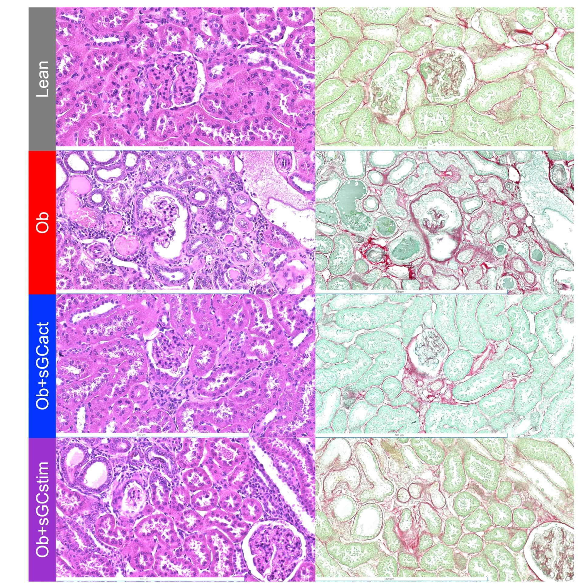 Open access visualization of Microscopy, Histopathology, Hematoxylin/Eosin, Sirius Red/Fast Green, Kidney Sections