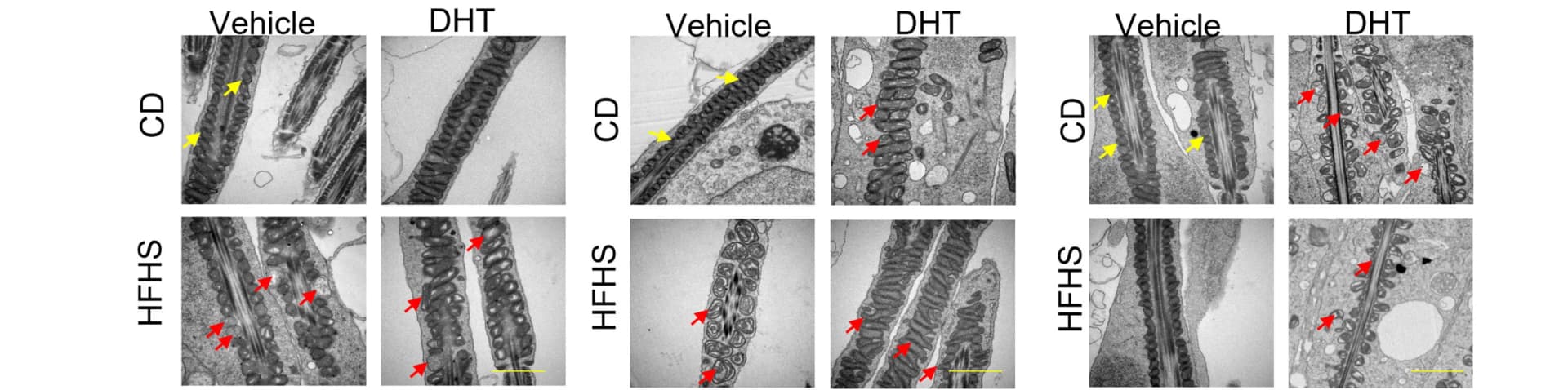 Open access visualization of Microscopy, Mitochondrial Sheath, Sperm, Testis, Male Offspring