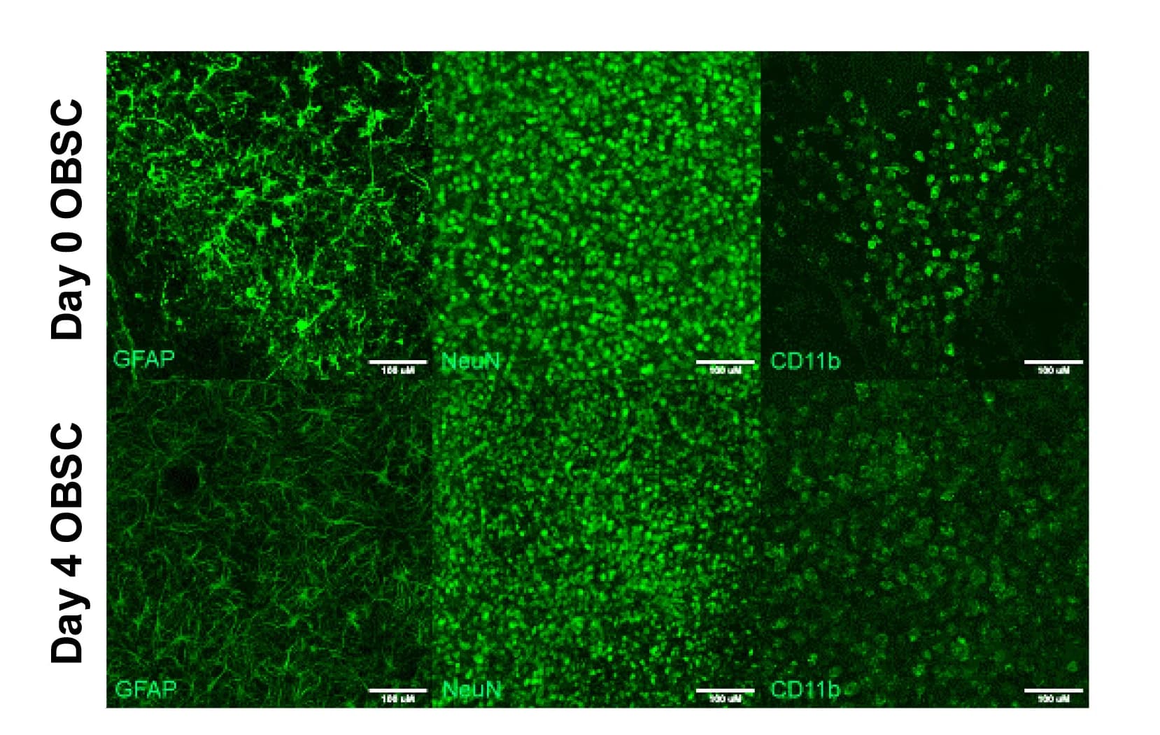Open access visualization of Microscopy, Immunofluorescence, Healthy OBSCs, Astrocytes, Neurons