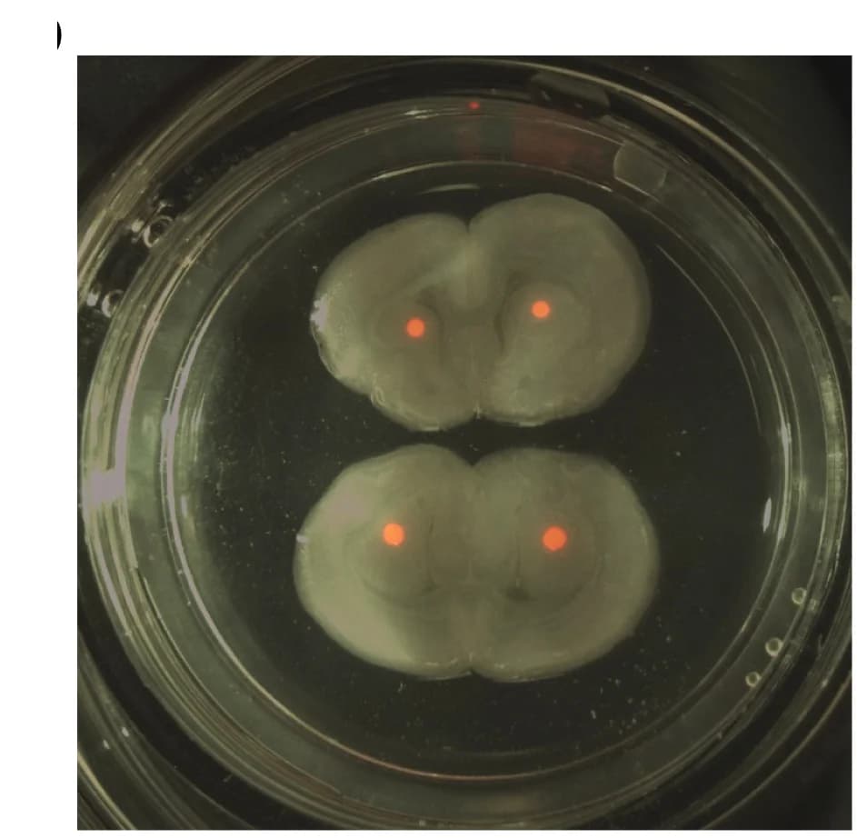 Open access visualization of Microscopy, Photo, Fluorescence Image, Tumor Foci, Thalamic Region