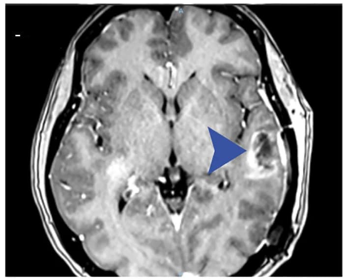 Open access visualization of Microscopy, MRI, Tumors, Irradiation