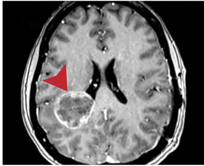 Open access visualization of Microscopy, MRI, Tumors, Irradiation