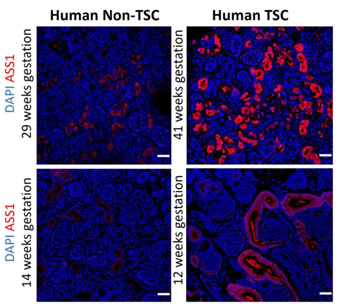 Open access visualization of Microscopy, Human, Renal Sections, Miscarriage Fetuses, Embryonic Stages