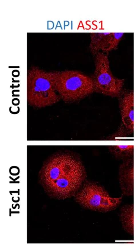 Open access visualization of Microscopy, ASS1 Immunostaining, Control, Tsc1KO, HK2 Cells