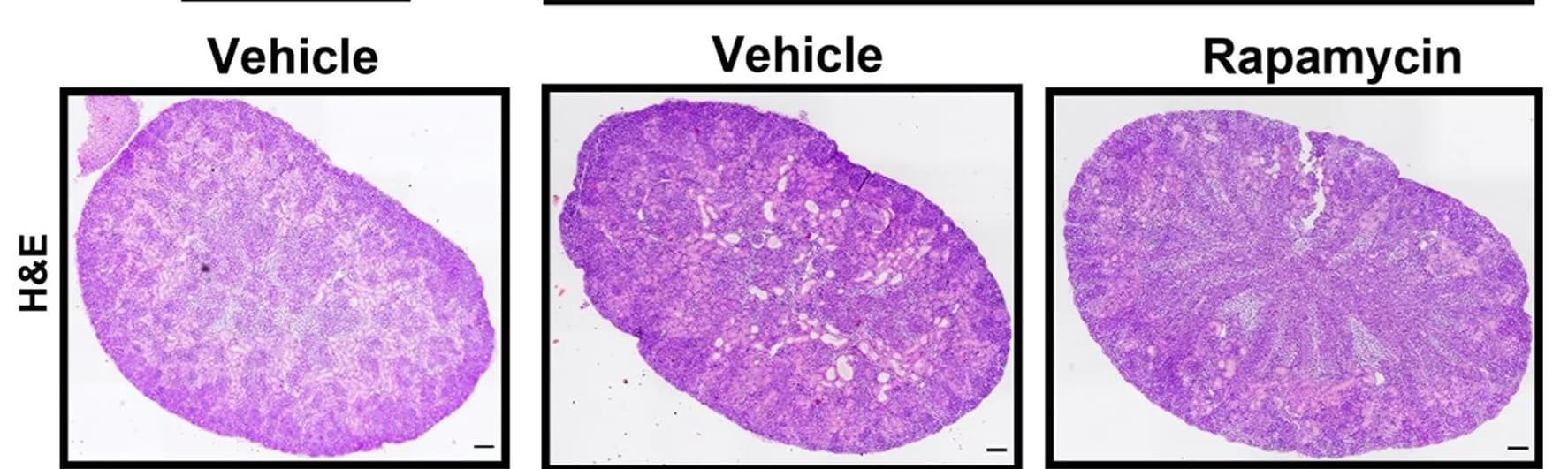 Open access visualization of Microscopy, Photo, Kidney, WT, Tsc1KO Mice