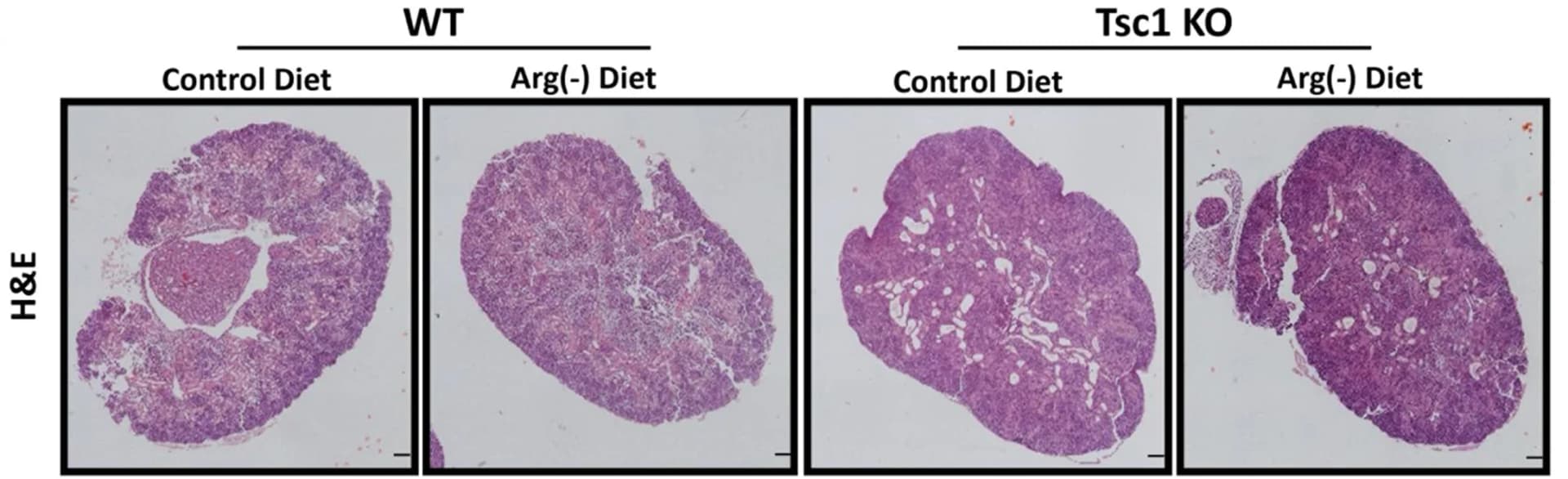 Open access visualization of Microscopy, H&E Staining, Kidney Sections, WT, Tsc1KO Pups