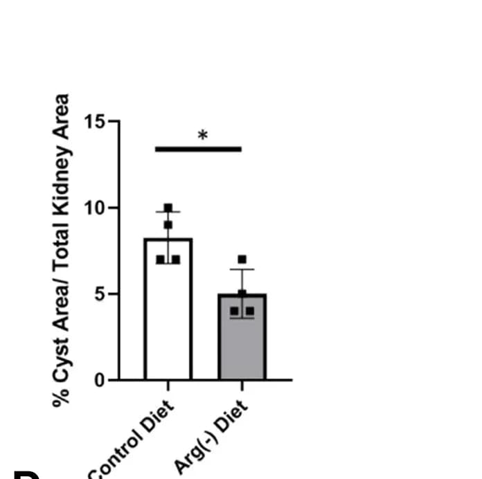Open access visualization of Bar Plot, Error Bars, Cyst Area, WT Pups, Control Diet