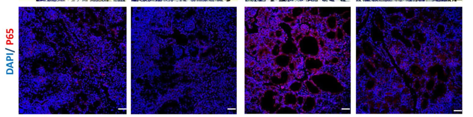 Open access visualization of Microscopy, Kidney Sections, Immunostaining, P65, Upregulation