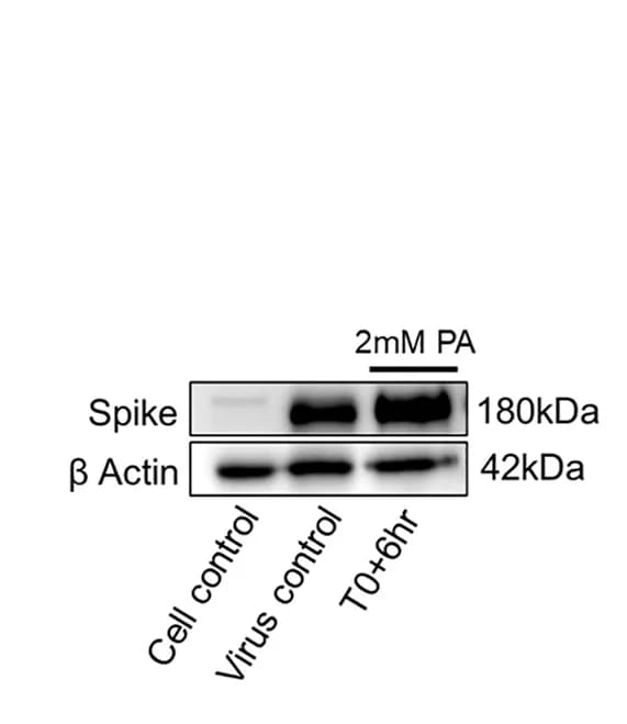Open access visualization of Gel, Entry Assays, SARS-CoV-2, Vero E6 Cells