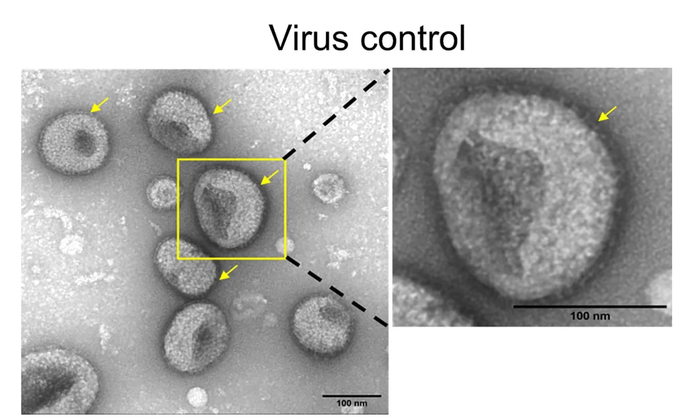 Open access visualization of Microscopy, Photo, TEM images, PR8 IAV particles, PA