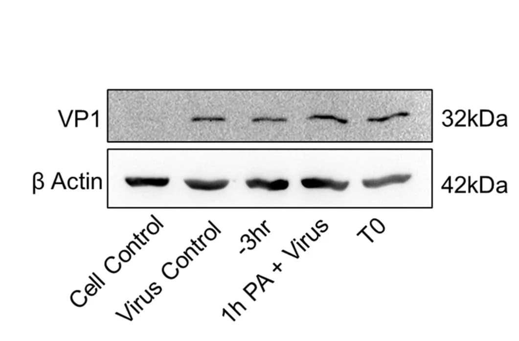 Open access visualization of Gel, HeLa Cells, Pre-treatment, CVB3 Infection, Western Blot