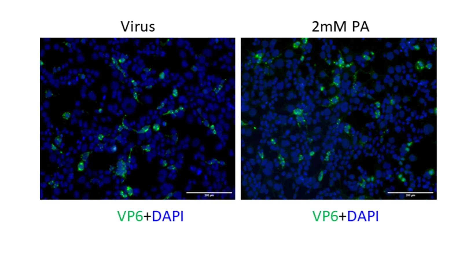 Open access visualization of Microscopy, HEK293T Cells, Pre-treatment, RRV Infection, Immunofluorescence Assay