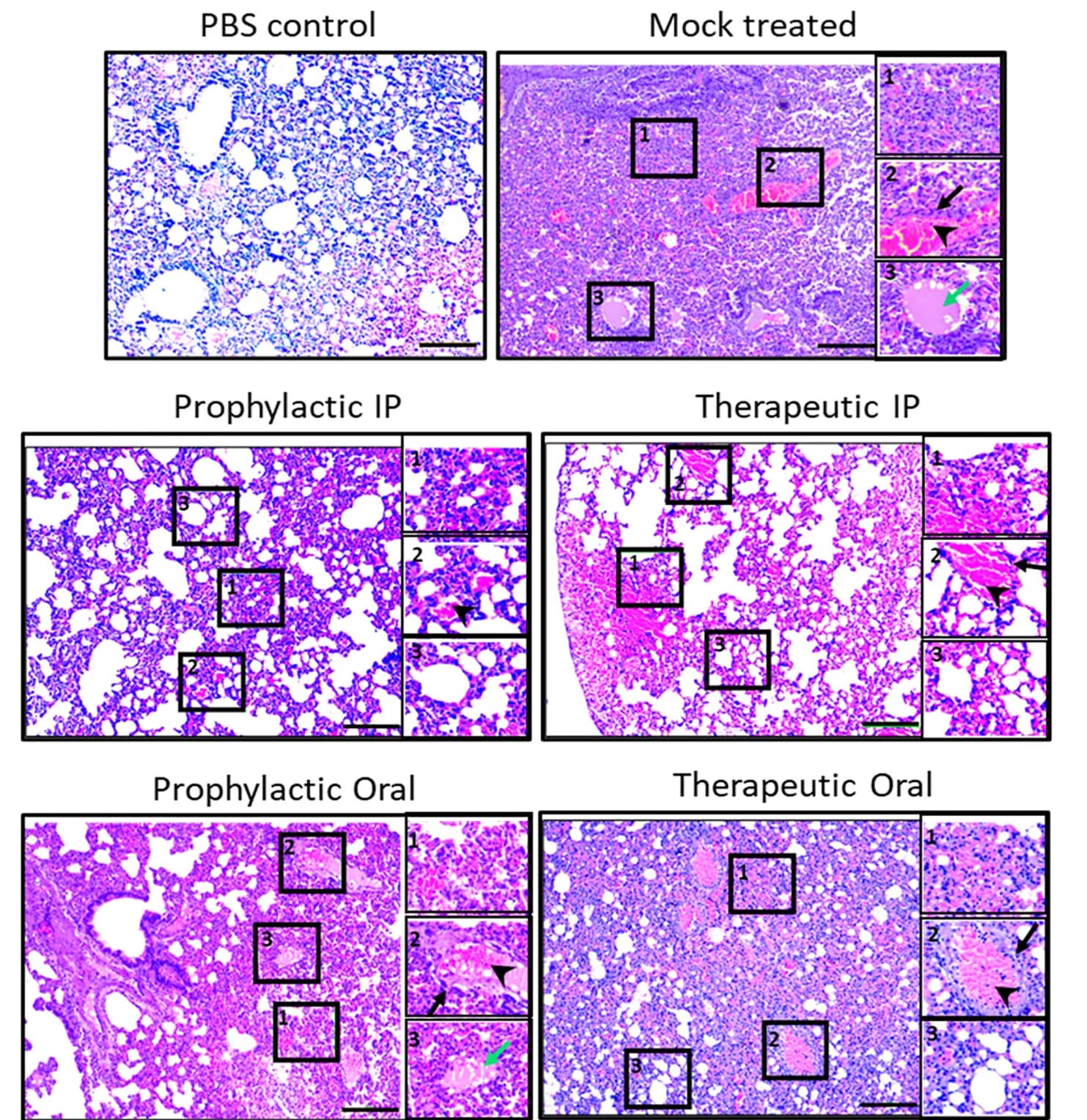Open access visualization of Microscopy, Histology, Clinical scoring, Alveolar edema, Vascular infiltration