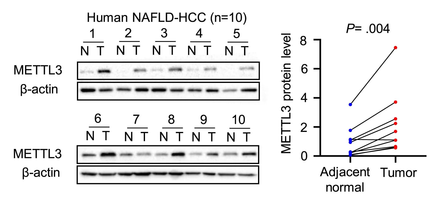 Open access visualization of Gel, Line Plot, Protein Expression, METTL3, Human NAFLD-HCC