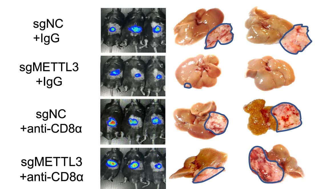 Open access visualization of Microscopy, Photo, Livers, NAFLD-HCC Tumors, METTL3