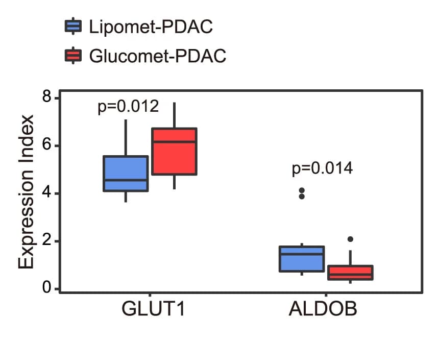 Open access visualization of Box Plot, ALDOB, GLUT1, Metabolic Subgroup, Gene Expression