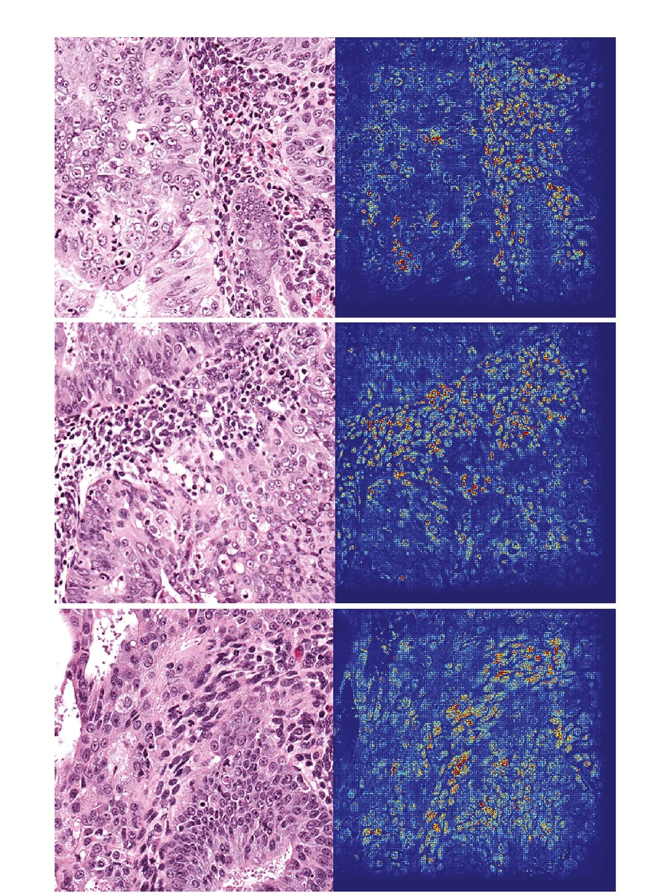 Open access visualization of Microscopy, Heatmap, Tiles, Saliency Results, Nuclei