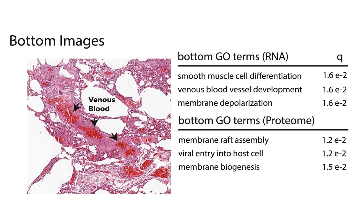 Open access visualization of Microscopy, Table Image, Tile Scoring, Biological Processes, Glycolytic Activity