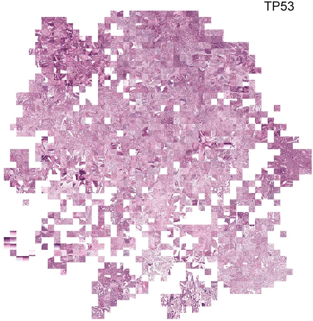 Open access visualization of Microscopy, Feature Extraction, Visualization, Pan-Cancer TP53 Mutation Model, tSNE