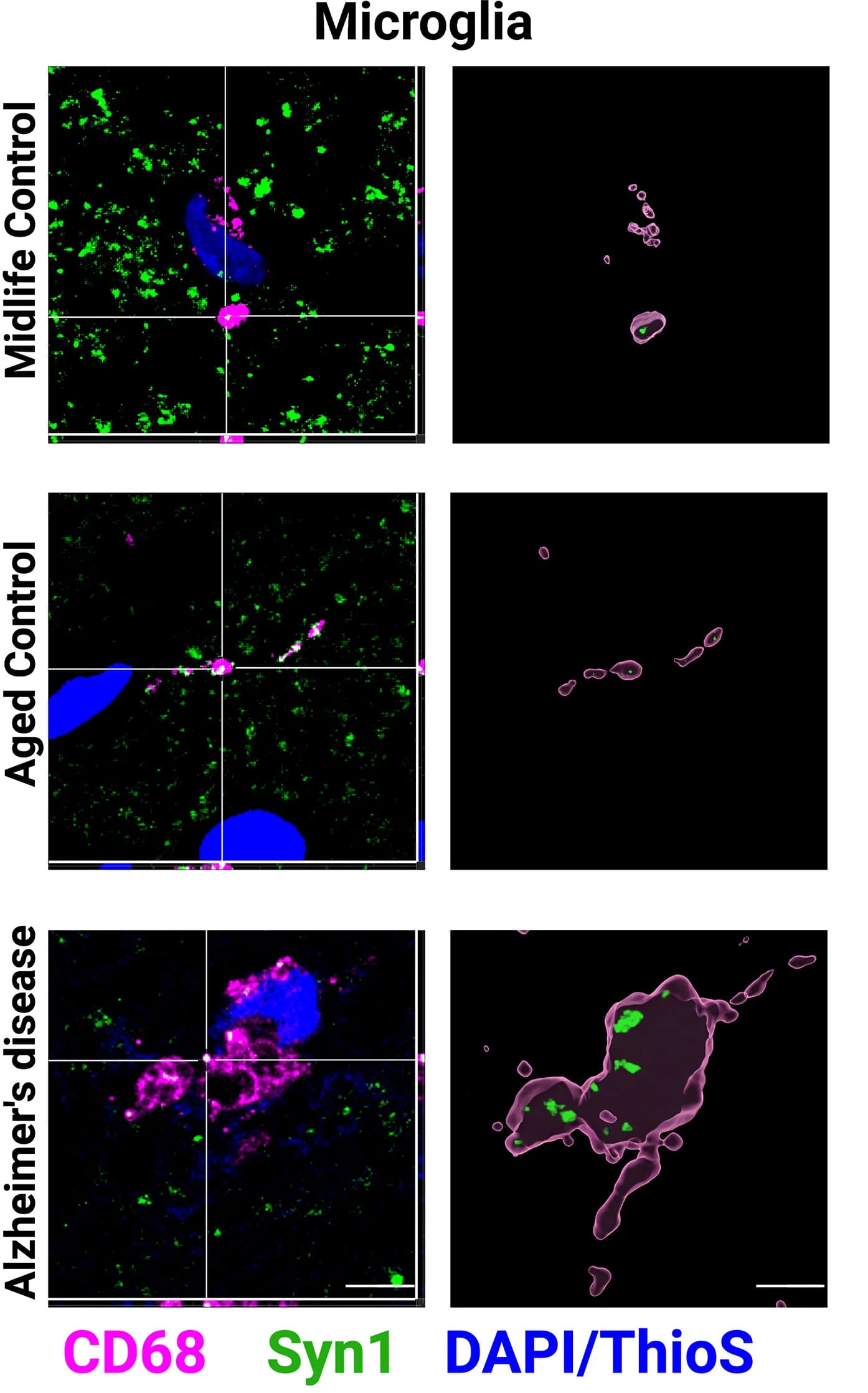 Open access visualization of Microscopy, Confocal Images, Immunostaining, Synapsin 1, Microglia