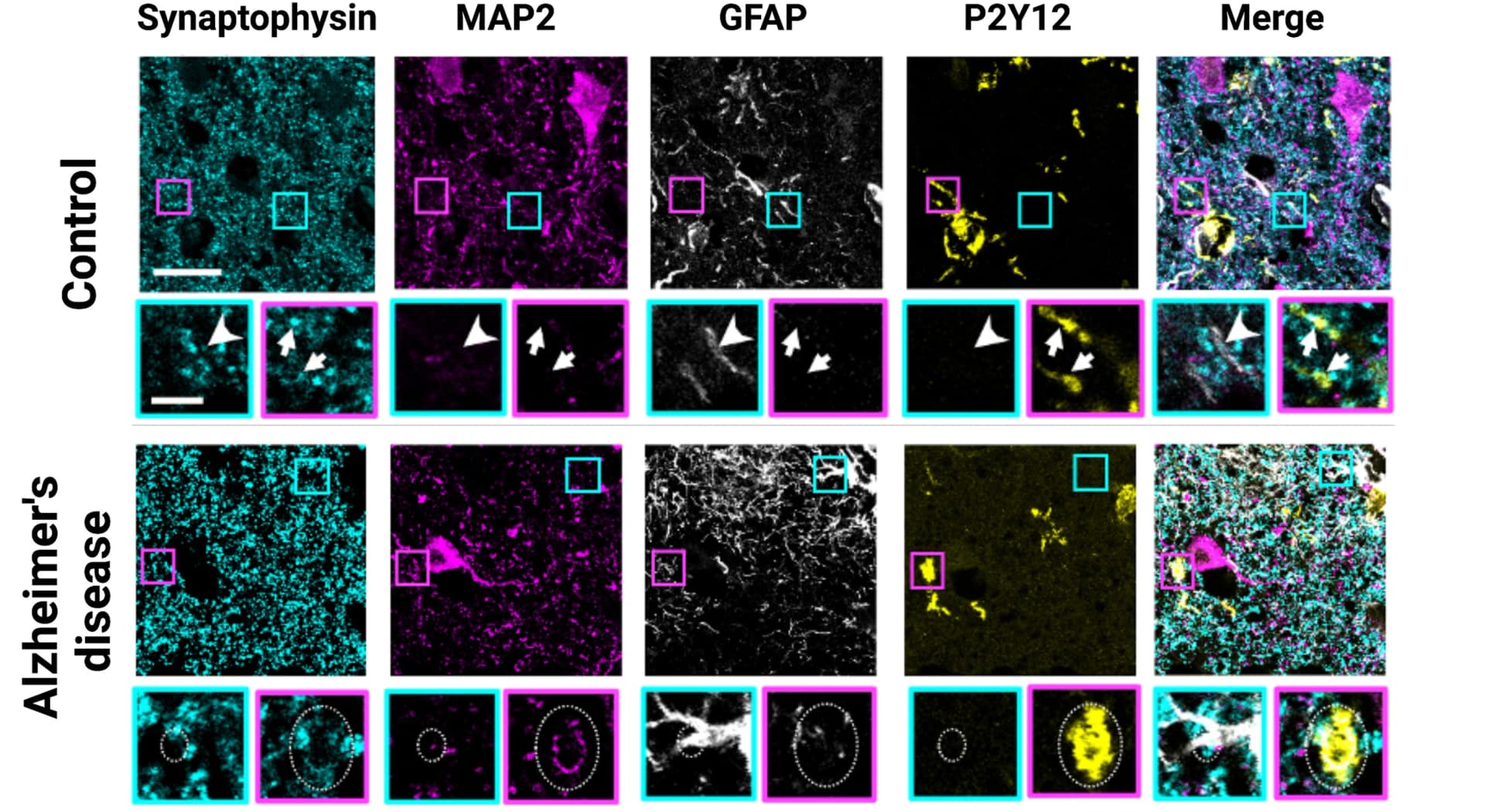 Open access visualization of Microscopy, Synaptophysin, Neuronal Neurites, Astrocytes, Microglia