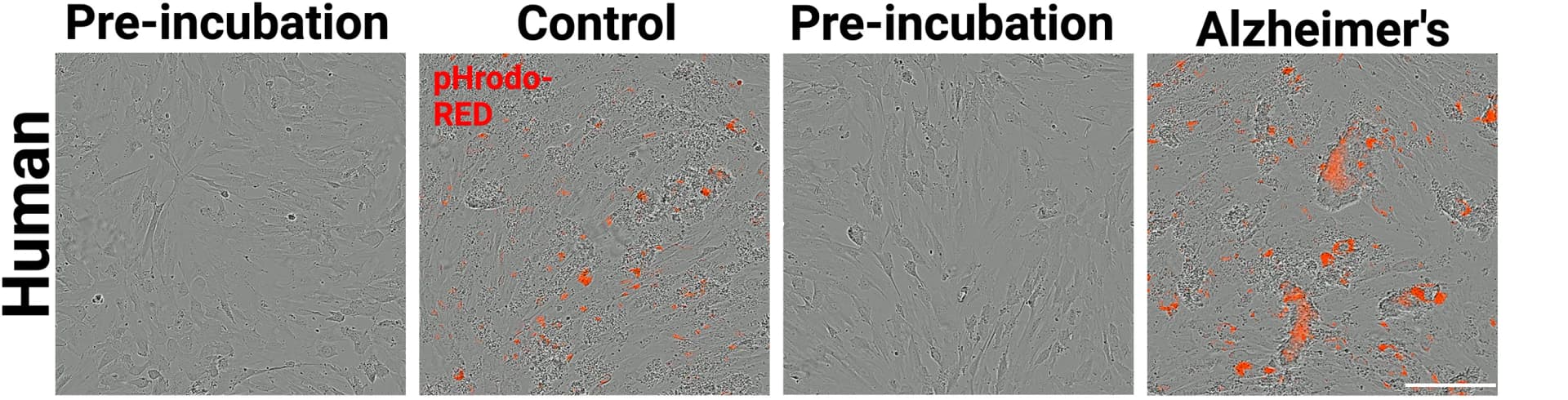 Open access visualization of Microscopy, Live-imaging assay, Human fetal astrocytes, Phagocytosis, Synaptoneurosomes