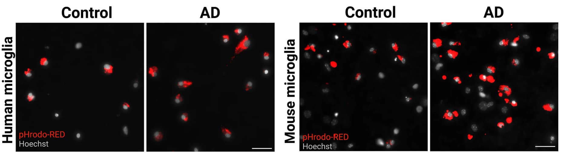 Open access visualization of Microscopy, Live Imaging, Microglia, Hoechst, pHrodo-Red
