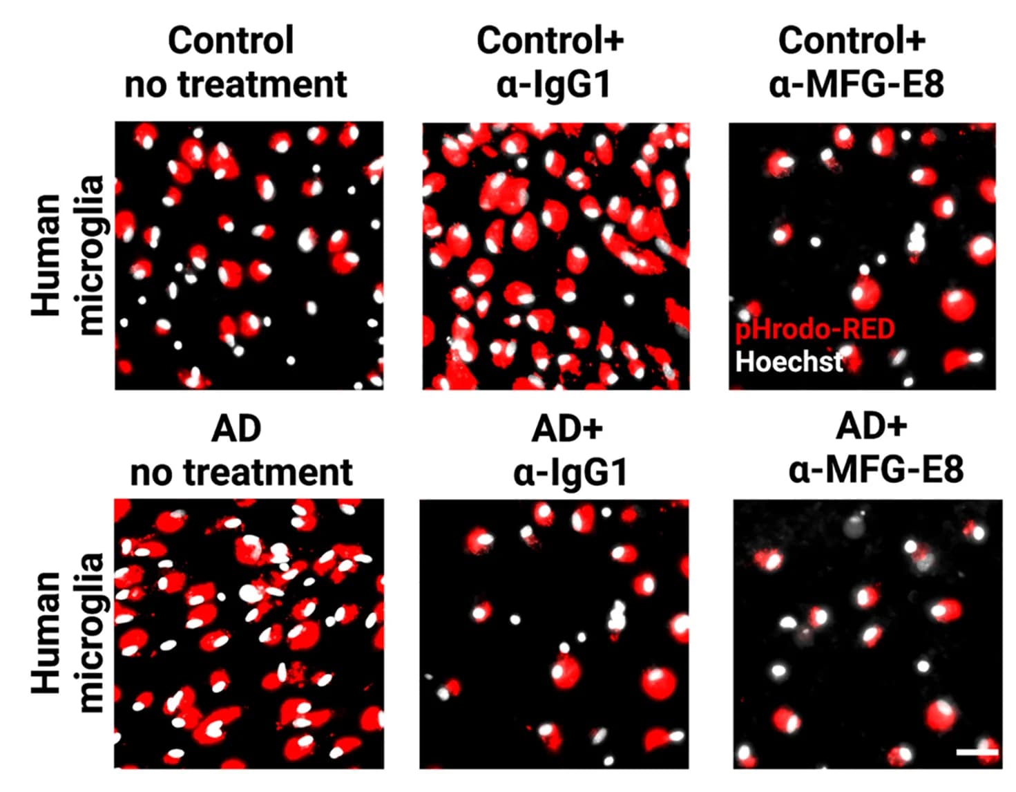 Open access visualization of Microscopy, Phagocytosis Assays, Human Microglia, Synaptoneurosomes, Control