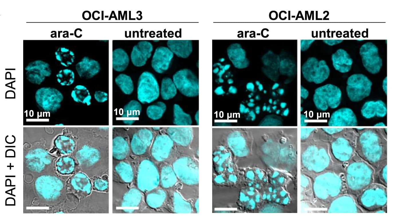 Open access visualization of Microscopy, DAPI staining, Chromatin Fragments, Nuclei, OCI-AML2 Cells