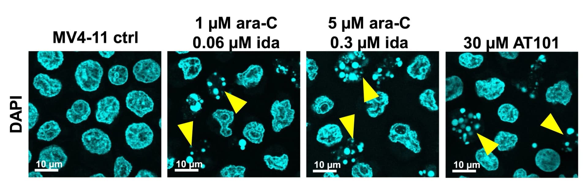 Open access visualization of Microscopy, DAPI Staining, Cytospin Centrifugation, Confocal Microscopy, Nuclear Fragmentation