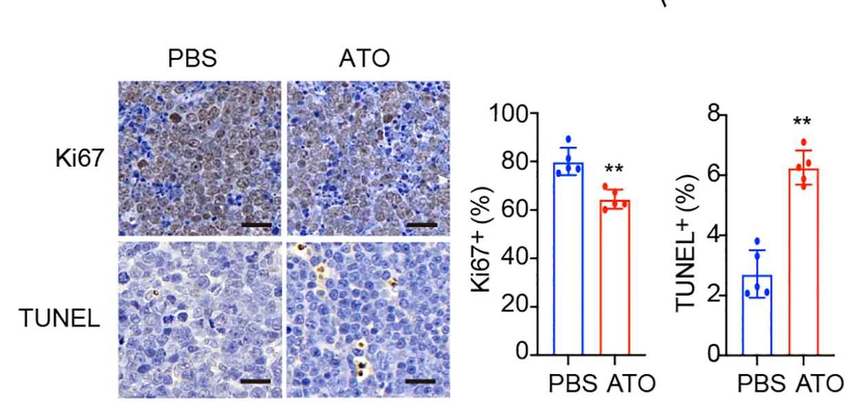 Open access visualization of Bar Plot, Error Bars, Microscopy, Immunohistochemical Staining, Ki67+ Cells