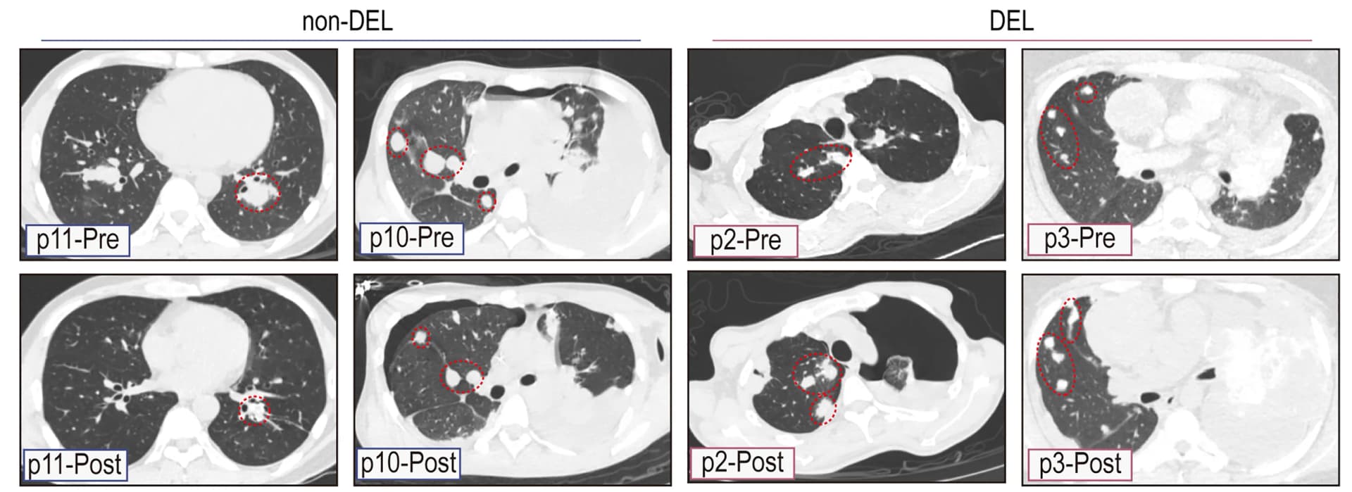 Open access visualization of Photo, Imaging, Immunotherapy, Pre-Treatment, Post-Treatment