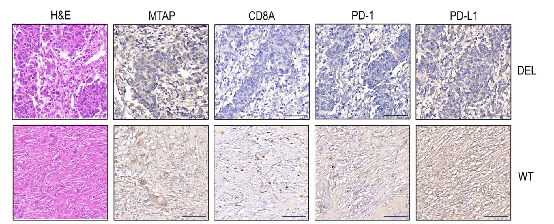 Open access visualization of Microscopy, Pathological Characteristics, Immunohistochemistry, MTAP, CD8A