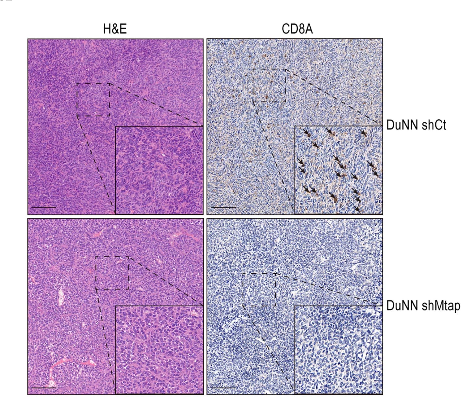 Open access visualization of Microscopy, Pathological Characteristics, Immunohistochemistry, Tumor Tissues, CD8A