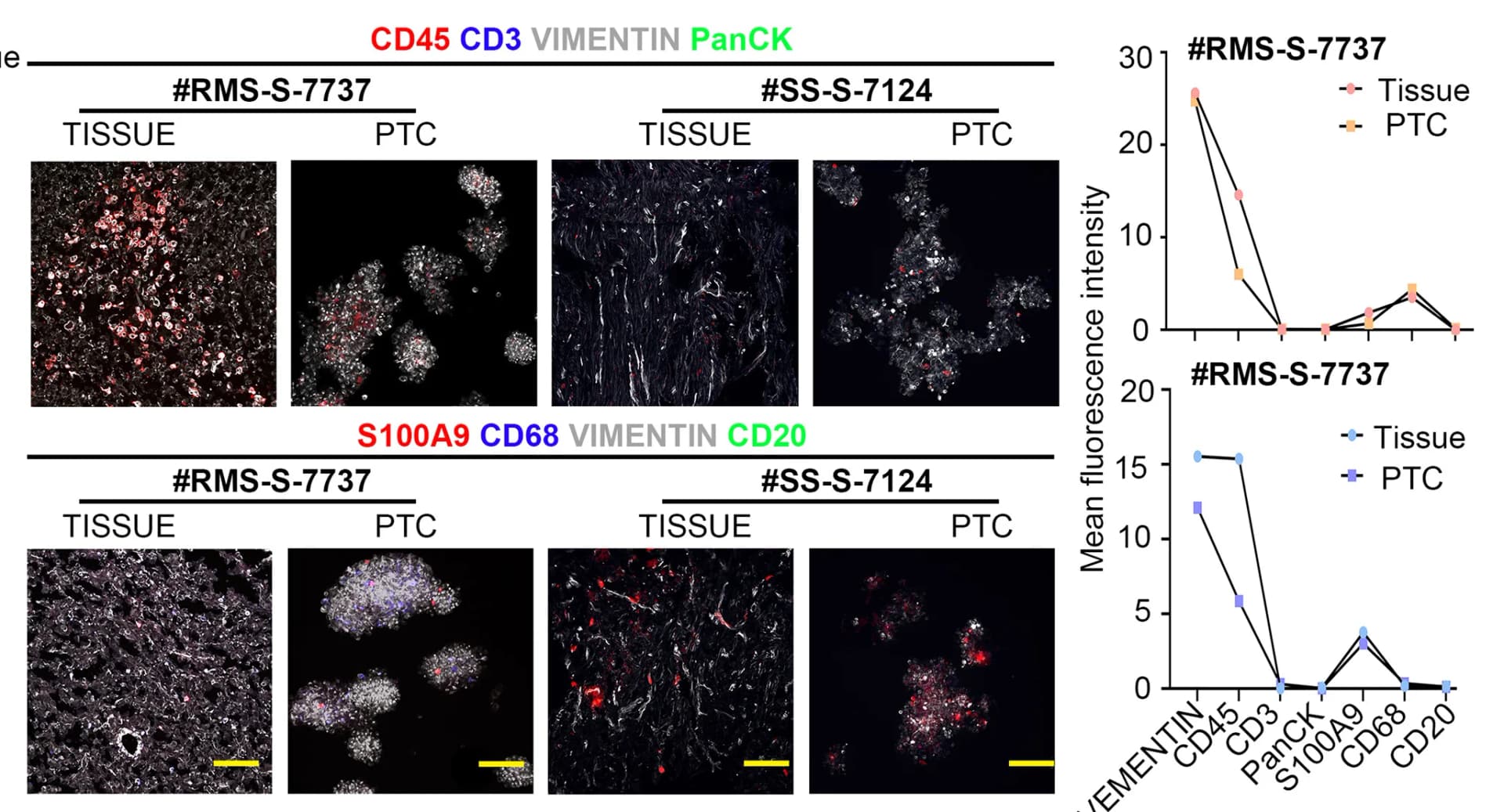 Open access visualization of Line Plot, Microscopy, Immunofluorescence Staining, Tumors, PTCs